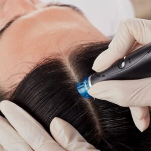 Hydrafacial Cuero Cabelludo 1 sesion