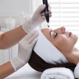 Microneedling